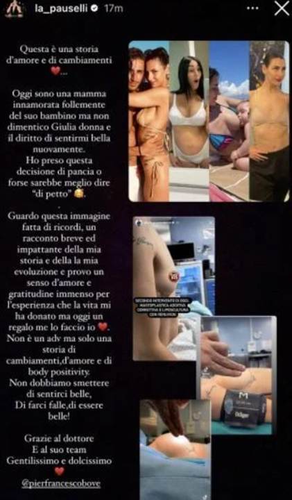 Giulia Pauselli operata al seno