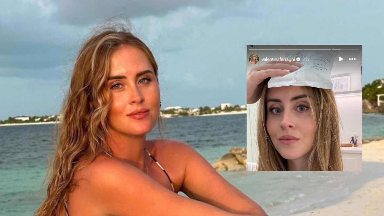 Valentina Ferragni rimuove un neo dalla testa: il ricordo del tumore del 2021